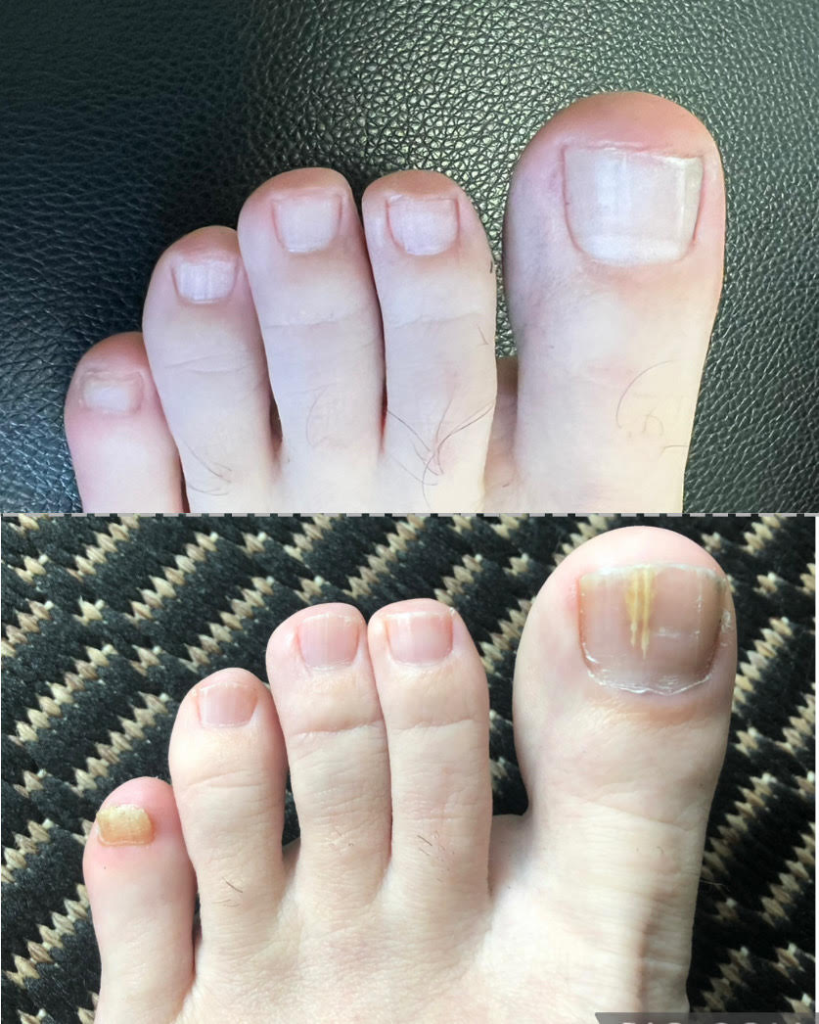 Severe Section Image